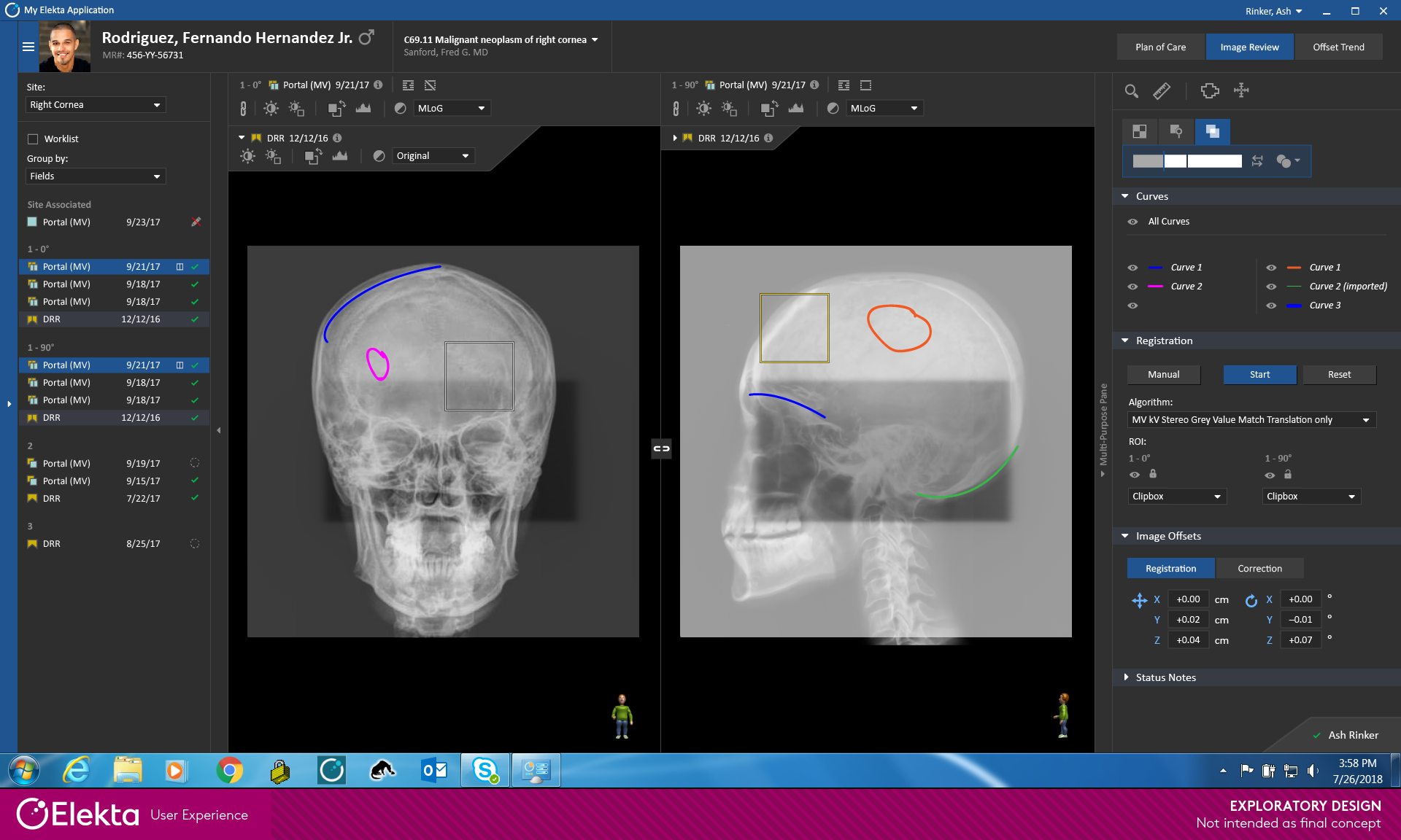 Screen shot of MOSAIQ 3 Image Viewer, showing cranial fusion images.